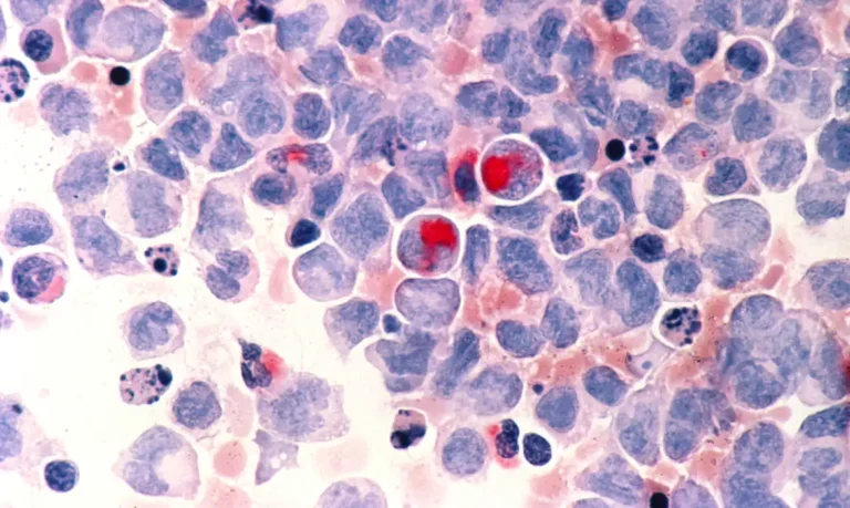 nci-vol-2336-300